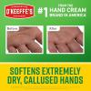 O’Keeffe’s Working Hands Intense Renewal Hand Cream, 3 oz Tube (Pack of 1) – Softens and Smooths Extremely Callused, Dry Hands(1 – Pack)