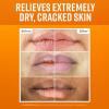 O’Keeffe’s Lip Repair Lip Balm Set for Dry, Cracked Lips – Stick (Pack of 3: 1 Cooling + 1 Unscented + 1 SPF) – Moisturizer for for Extremely Cracked, Dry Lips
